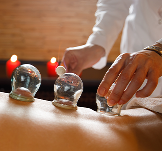 Fire Cupping